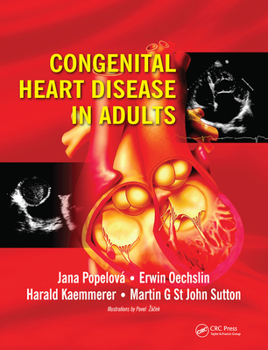 Paperback Congenital Heart Disease in Adults Book