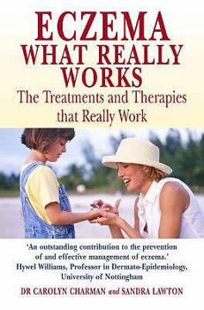 Paperback Eczema: What Really Works. Carolyn Charman and Sandra Lawton Book