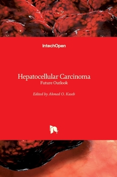 Hardcover Hepatocellular Carcinoma: Future Outlook Book