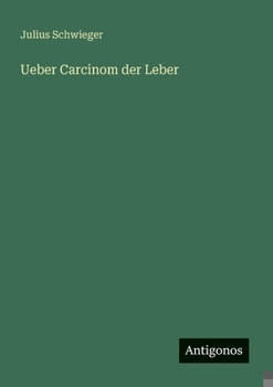 Paperback Ueber Carcinom der Leber [German] Book