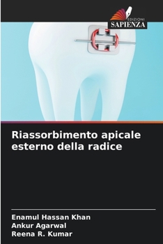 Paperback Riassorbimento apicale esterno della radice [Italian] Book