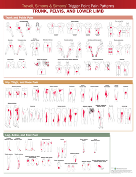 Wall Chart Travell, Simons & Simons' Trigger Point Pain Patterns Wall Chart: Trunk, Pelvis, and Lower Limb Book