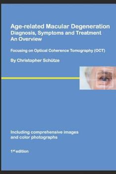 Paperback Age-related Macular Degeneration, Diagnosis, Symptoms and Treatment, An Overview: Focusing on Optical Coherence Tomography Book