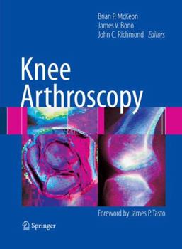 Hardcover Knee Arthroscopy Book