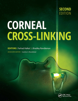 Hardcover Corneal Cross-Linking Book