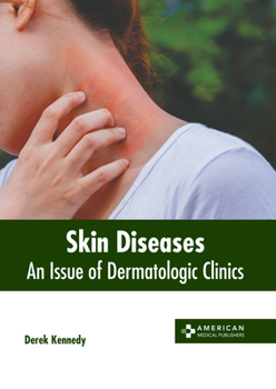 Hardcover Skin Diseases: An Issue of Dermatologic Clinics Book