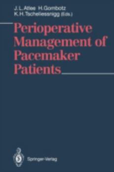 Paperback Perioperative Management of Pacemaker Patients Book