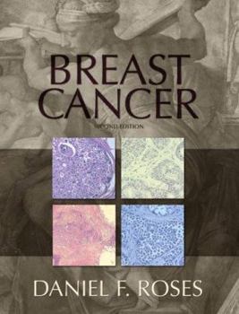 Hardcover Breast Cancer Book