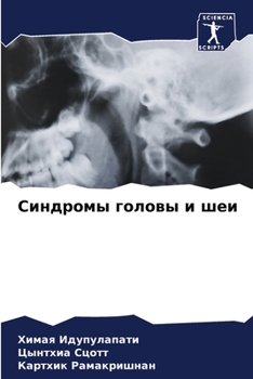 Paperback Синдромы головы и шеи [Russian] Book