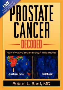 Paperback Prostate Cancer Decoded: Non-Invasive Breakthrough Treatments Book
