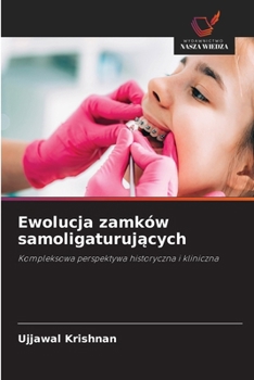 Ewolucja zamków samoligaturujacych (Polish Edition)