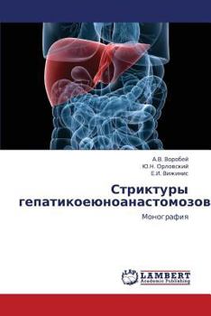 Paperback Striktury Gepatikoeyunoanastomozov [Russian] Book