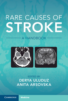 Paperback Rare Causes of Stroke: A Handbook Book
