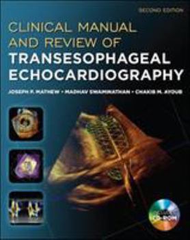 Paperback Clinical Manual and Review of Transesophageal Echocardiography, Second Edition Book