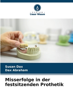 Paperback Misserfolge in der festsitzenden Prothetik [German] Book