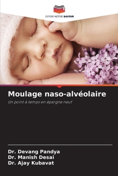 Paperback Moulage naso-alvéolaire [French] Book