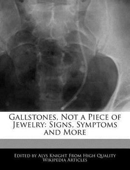 Gallstones, Not a Piece of Jewelry : Signs, Symptoms and More