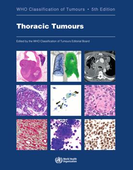 Paperback Thoracic Tumours: Who Classification of Tumours Book