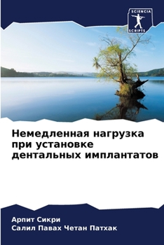 Paperback Немедленная нагрузка пр& [Russian] Book