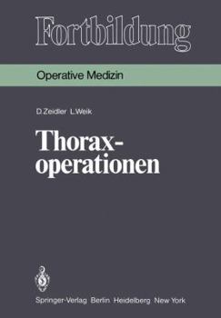 Paperback Thoraxoperationen [German] Book