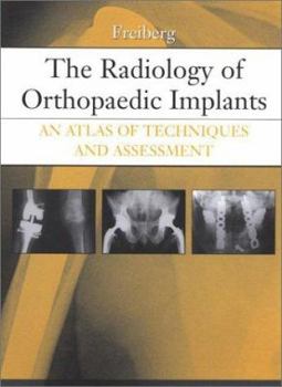 Hardcover The Radiology of Orthopaedic Implants: An Atlas of Techniques and Assessment Book