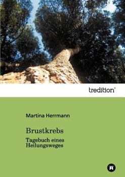 Paperback Brustkrebs [German] Book