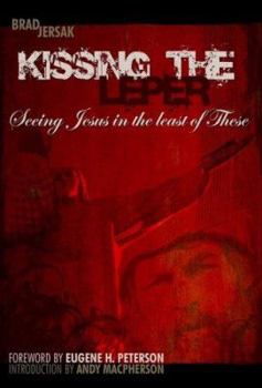 Paperback Kissing the Leper: Seeing Jesus in the Least of These Book