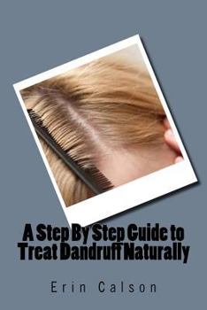 Paperback A Step By Step Guide to Treat Dandruff Naturally Book