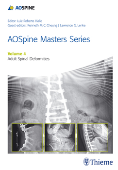 Hardcover Aospine Master Series, Vol. 4: Adult Spinal Deformities Book