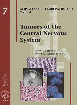 Hardcover Tumors of the Central Nervous System Book