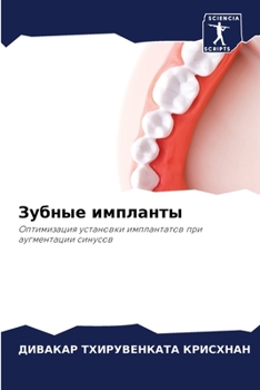 Paperback Зубные импланты [Russian] Book