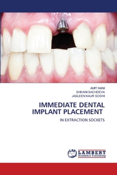 Paperback Immediate Dental Implant Placement Book