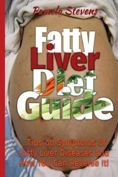 Paperback Fatty Liver Diet Guide: Tips on Symptoms of Fatty Liver Diseases and How You Can Reverse It! Book