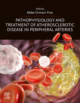 Paperback Pathophysiology and Treatment of Atherosclerotic Disease in Peripheral Arteries Book