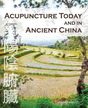 Paperback Acupuncture Today and in Ancient China Book