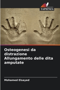 Paperback Osteogenesi da distrazione Allungamento delle dita amputate [Italian] Book