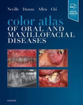 Hardcover Color Atlas of Oral and Maxillofacial Diseases Book
