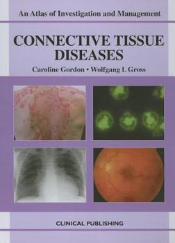 Hardcover Connective Tissue Disorders: An Atlas of Investigation and Management Book