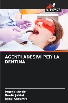 Paperback Agenti Adesivi Per La Dentina [Italian] Book