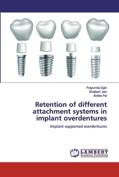 Paperback Retention of different attachment systems in implant overdentures Book