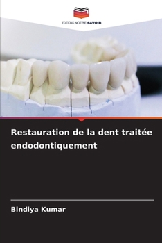Paperback Restauration de la dent traitée endodontiquement [French] Book