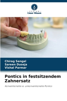 Paperback Pontics in festsitzendem Zahnersatz [German] Book