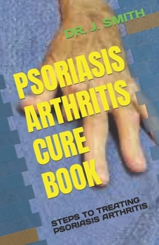 Paperback Psoriasis Arthritis Cure Book: Steps to Treating Psoriasis Arthritis Book