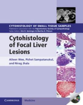 Cytohistology of Focal Liver Lesions - Book  of the Cytohistology of Small Tissue Samples