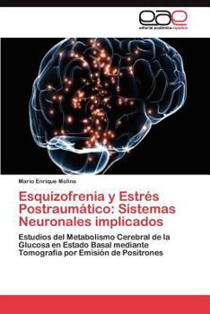 Paperback Esquizofrenia y Estrés Postraumático: Sistemas Neuronales implicados [Spanish] Book