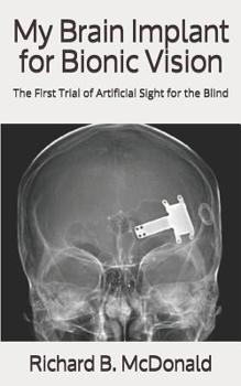 Paperback My Brain Implant for Bionic Vision: The First Trial of Artificial Sight for the Blind Book