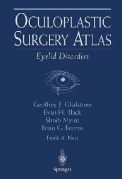 Hardcover Oculoplastic Surgery Atlas: Eyelid Disorders Book