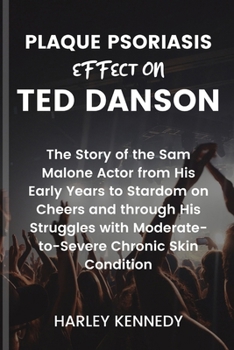 Plaque Psoriasis Effect on Ted Danson: The Story of the Sam Malone Actor from His Early Years to Stardom on Cheers and through His Struggles with Mode
