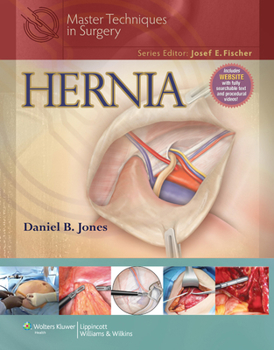 Hardcover Master Techniques in Surgery: Hernia Book