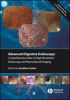 Comprehensive Atlas of High Resolution Endoscopy and Narrowband Imaging